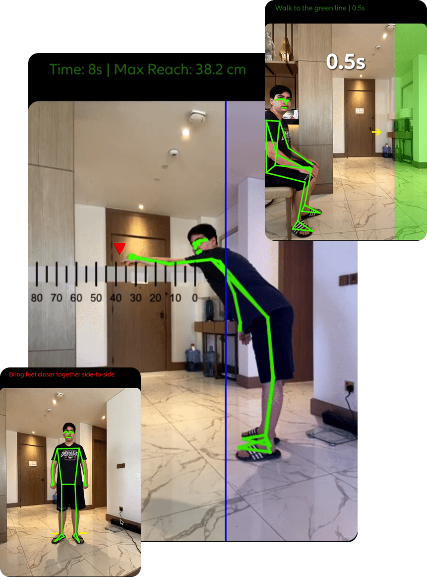 AI-powered rehabilitation guidance